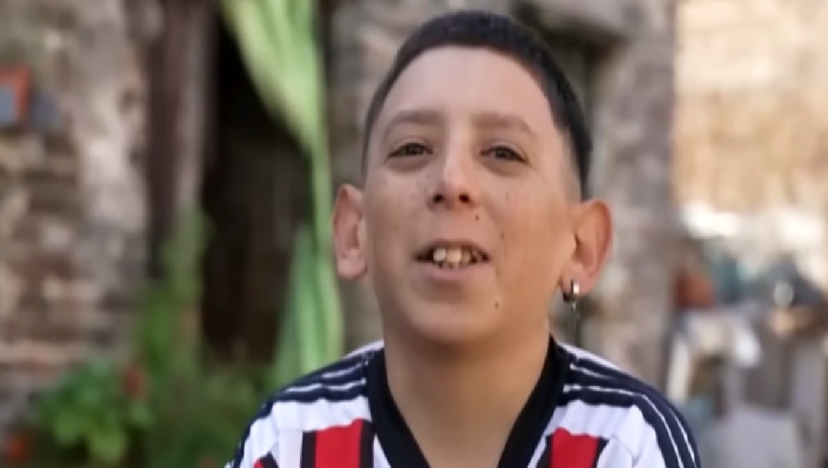 'Pollo', el argentino de 31 años que parece un niño de 10. | Telenoche