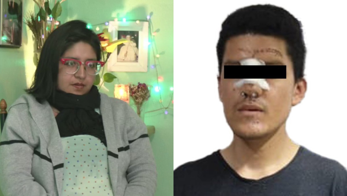 Arely Escobar fue agredida por Gabriel 'N' en mayo de 2024 | Especial