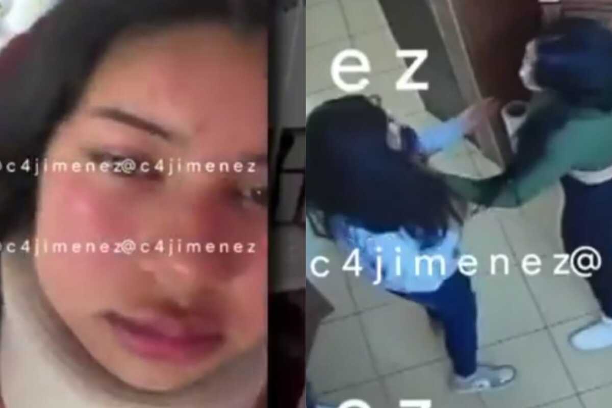 La víctima terminó con un collarín en el cuello.