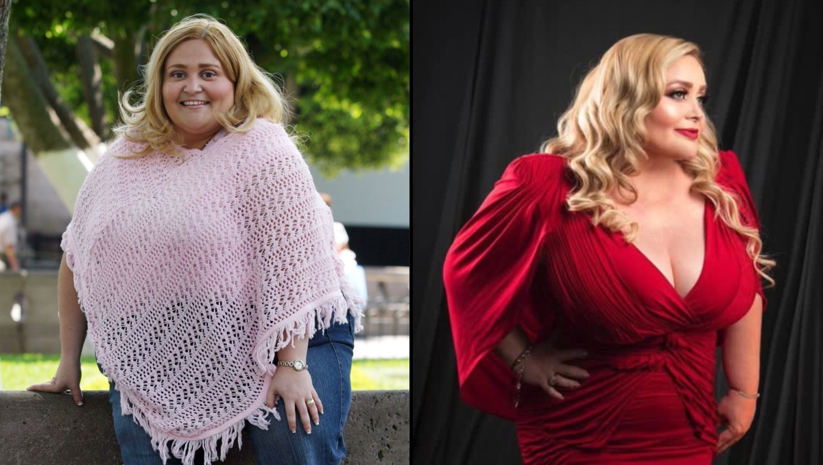 Sheyla, la cantante, bajó casi 60 kilos y donó su piel a niños quemados | ESPECIAL