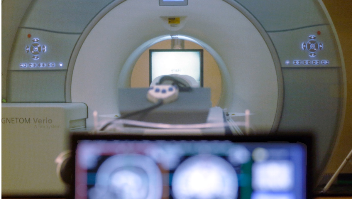 Hombre muere al ser arrastrado por una máquina de resonancia magnética en NY | AP