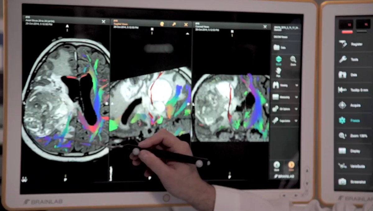Día Mundial del Cerebro: la nueva era de la neurotecnología