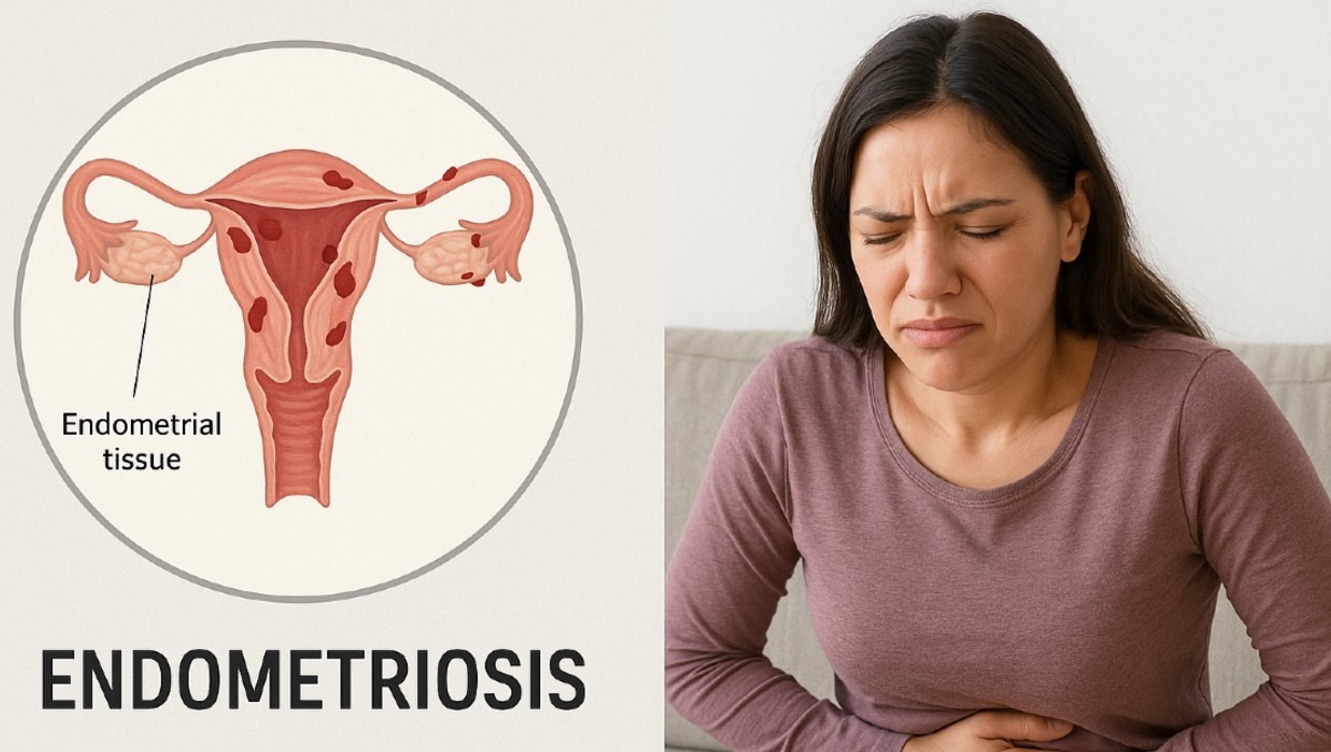 Ginecóloga experta busca no normalizar el dolor menstrual.
