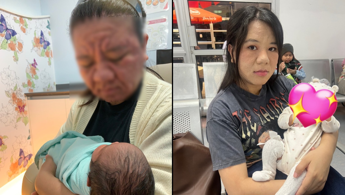 Mujer de 28 años sufre grave deformación en su rostro | ESPECIAL
