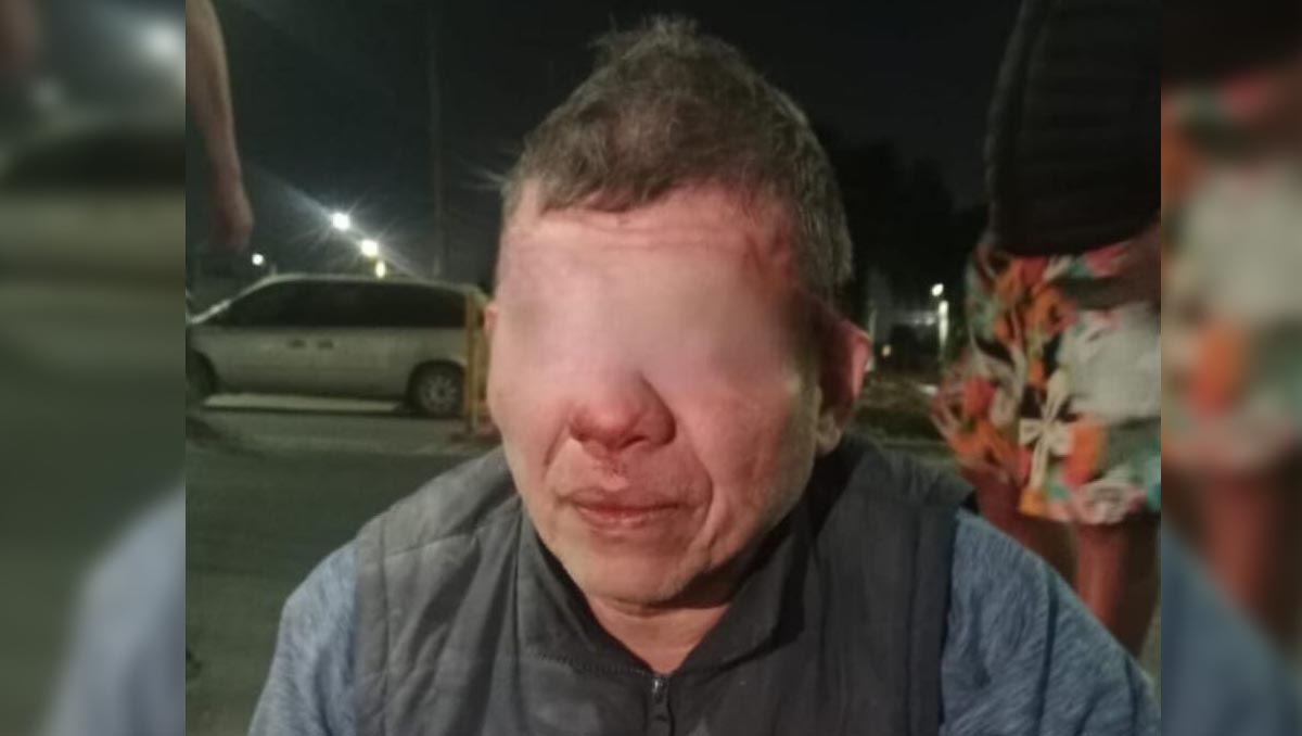 La policía municipal intervino para rescatar al presunto agresor de la multitud.