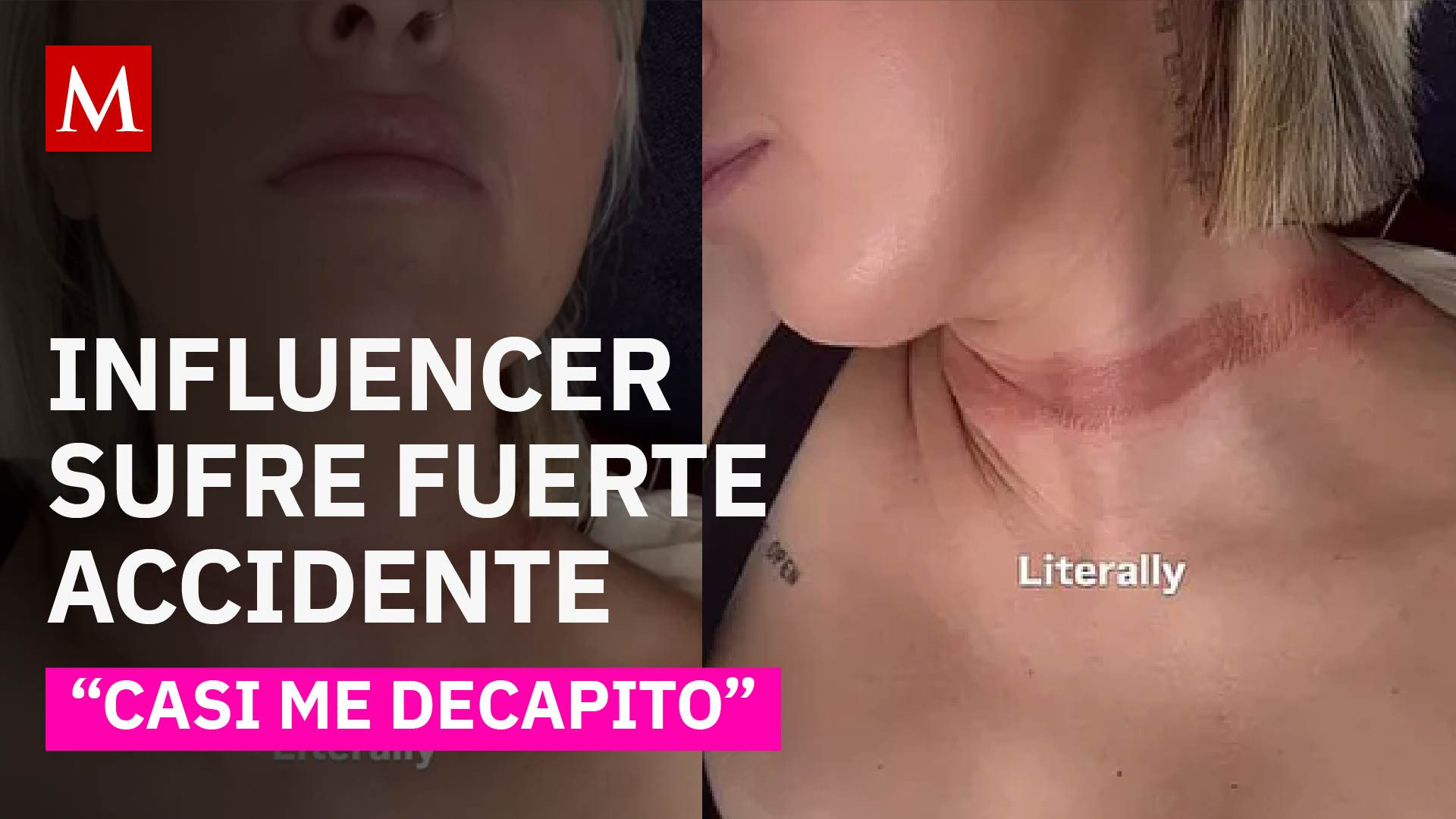 La influencer Eli Moulton casi se convierte en una 'Fashion Victim' mortal por un accesorio