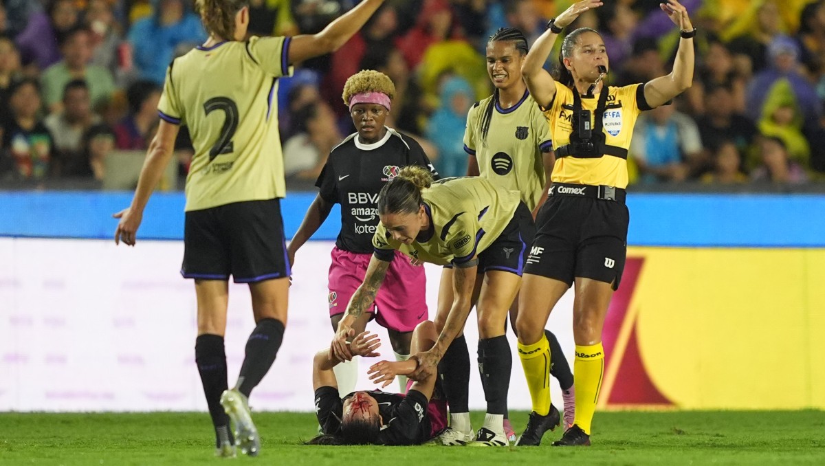 Charlyn Corral presenta herida facial tras sufrir golpe de Mapi León (Imago7)