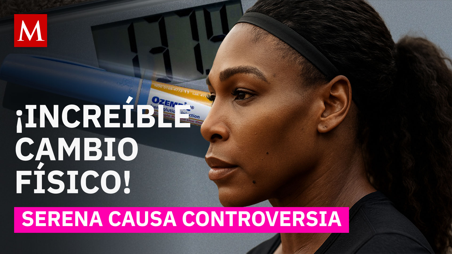 La drástica pérdida de peso de Serena Williams genera preocupación