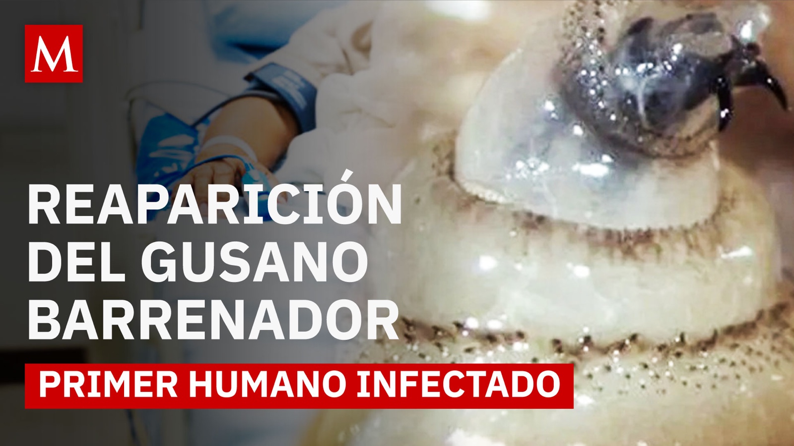 ¿Debemos preocuparnos? El gusano barrenador reaparece con un caso confirmado en humano