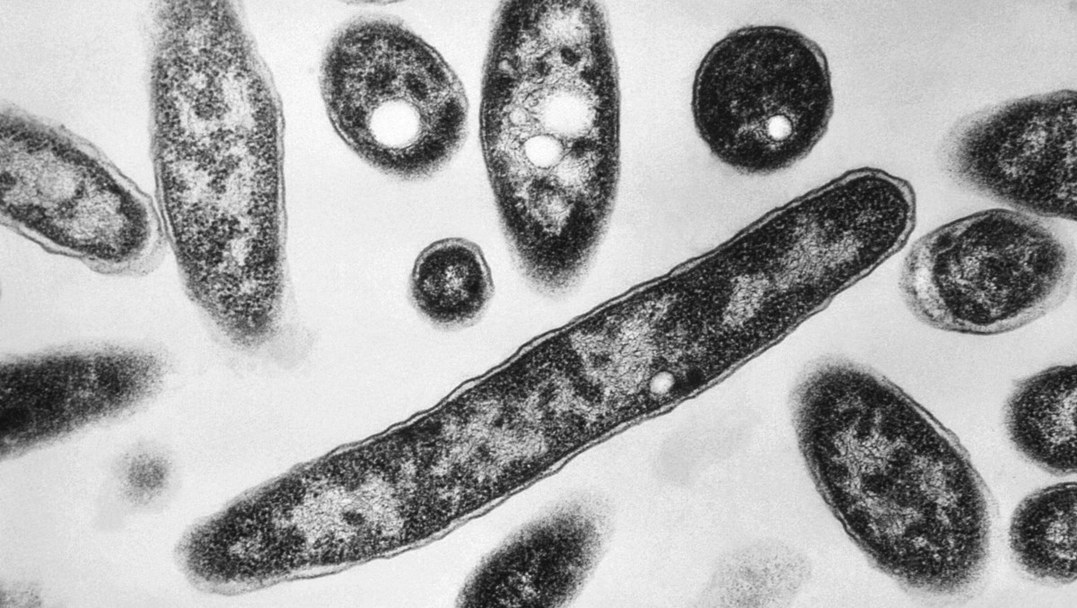 La Legionella es una bacteria que se propaga en cuerpos de agua. | AP