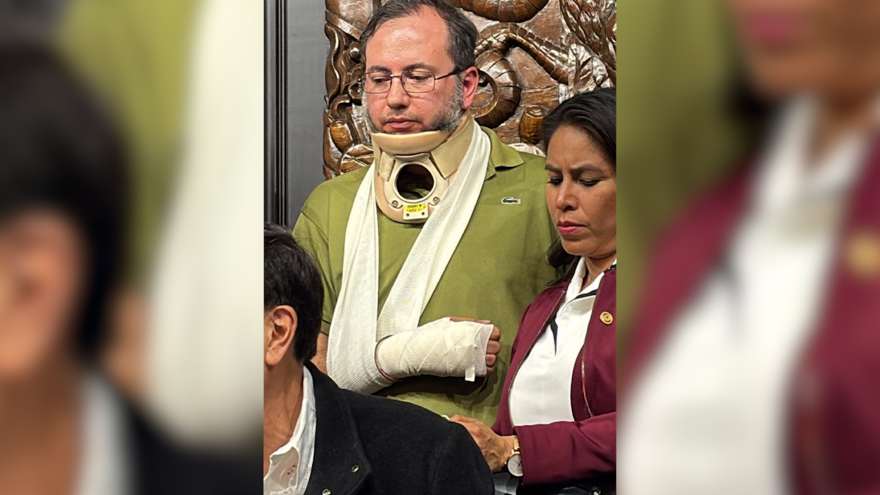 Colaborador de Noroña aparece con collarín tras altercado, pero genera dudas