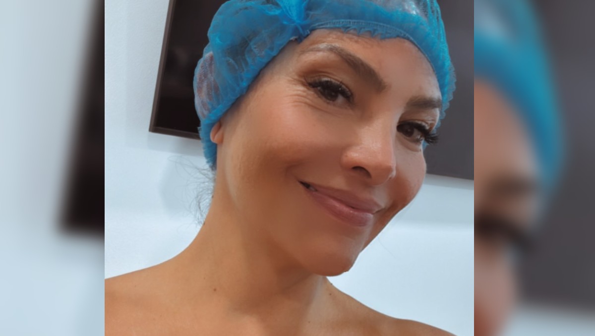 Fabiola Campomanes se quita implantes mamarios tras problemas de salud. | FOTO: Fabiola Campomanes