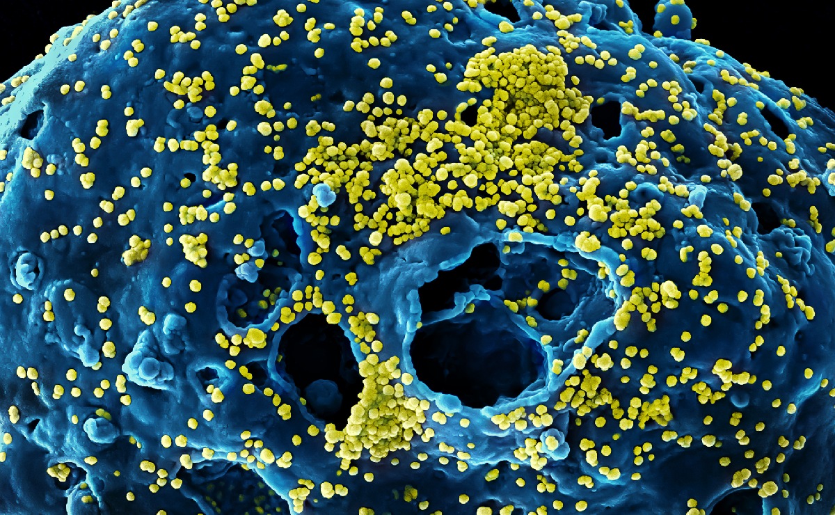 Partículas virales (en amarillo) adheridas a la superficie de una célula infectada. (Wikimedia Commons)