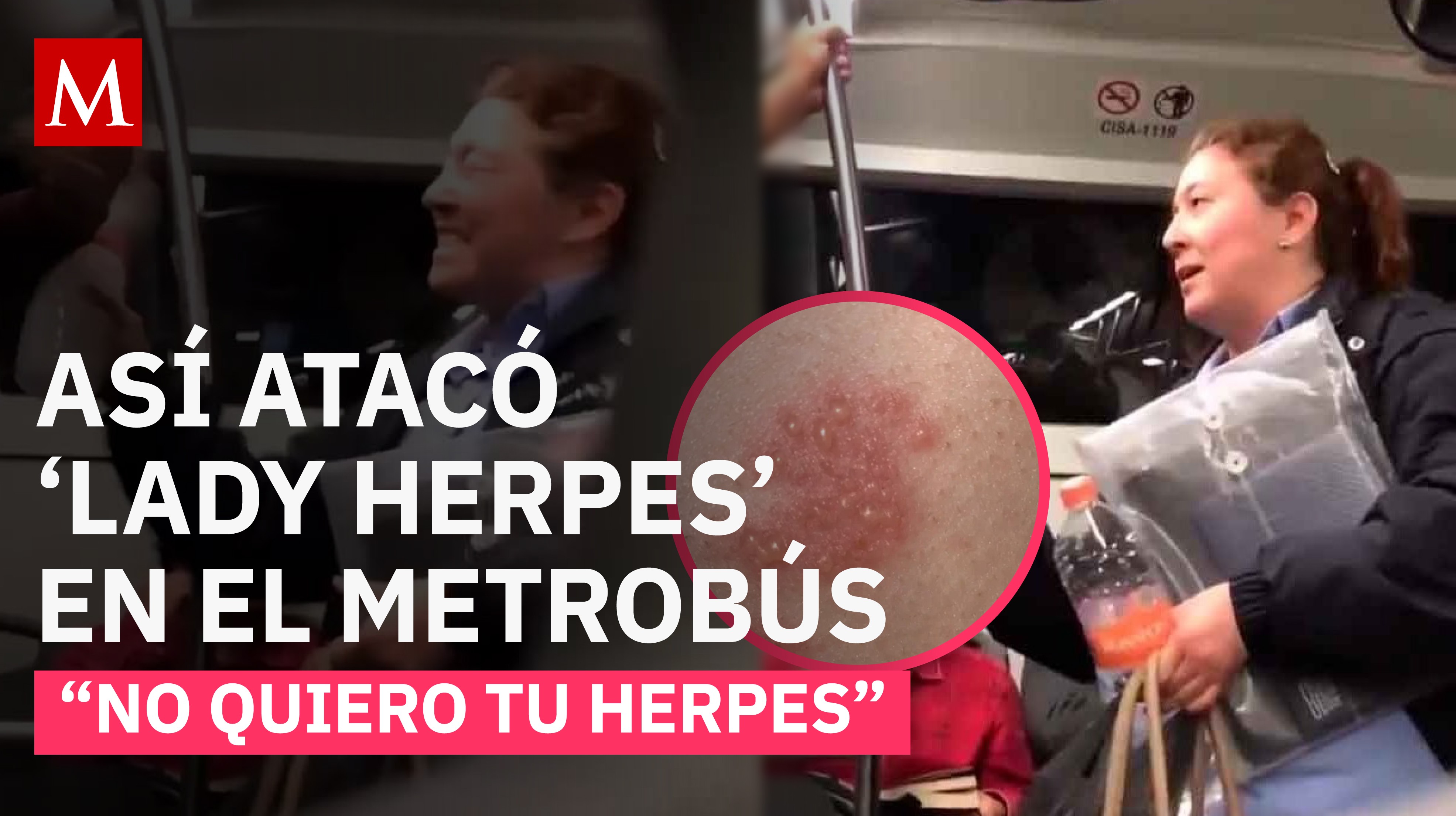 ¿Quién es Lady Herpes y por qué atacó a un joven en CDMX? El video que desató polémica