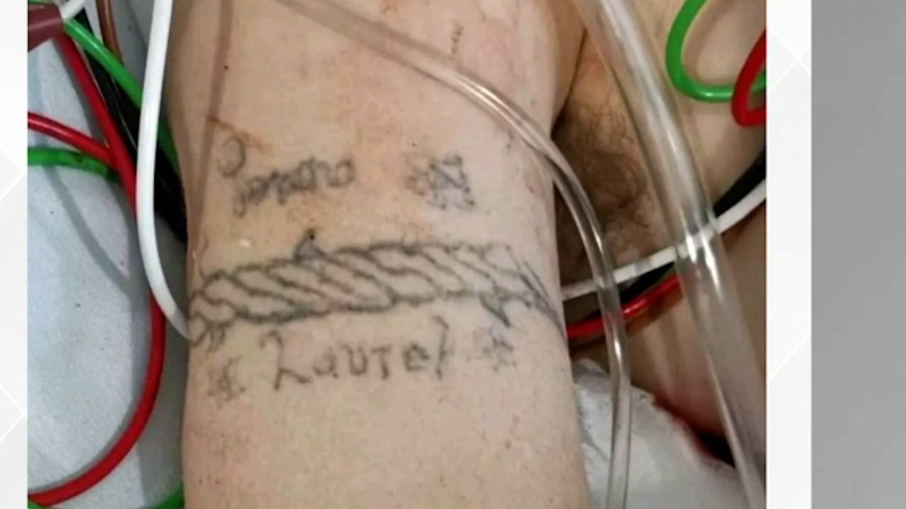 Solicitan apoyo para identificar a joven hospitalizada tras explosión en Iztapalapa