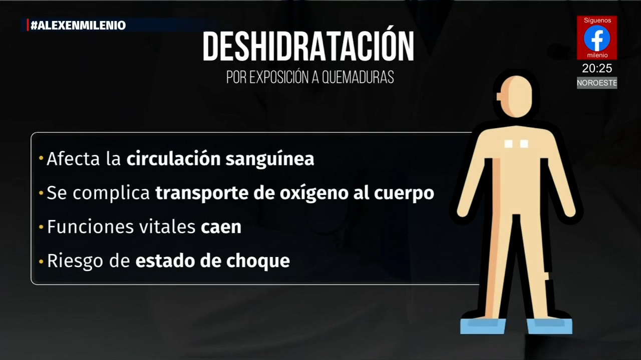 Atención especializada es clave para pacientes con quemaduras