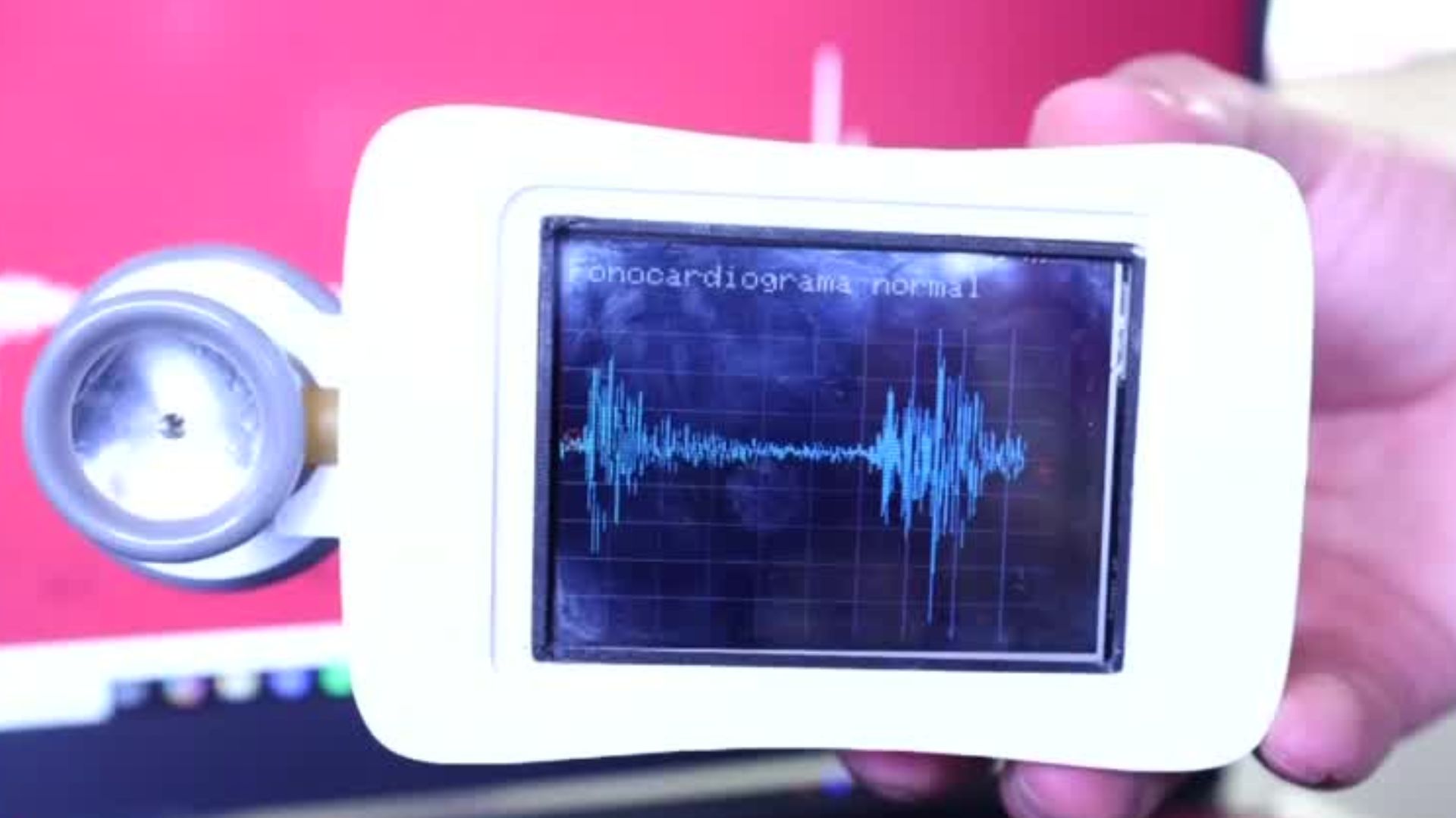 IPN crea estetoscopio que diagnostica daño cardiaco por medio de IA