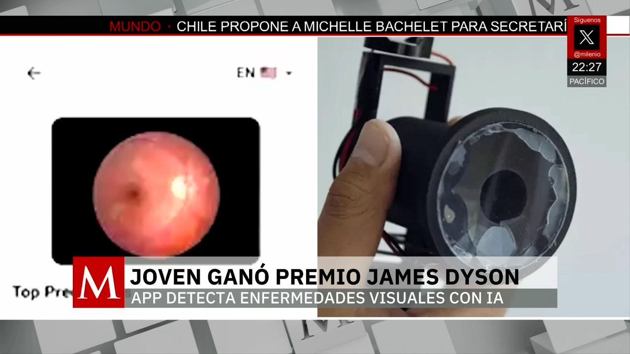 Ingeniero mexicano gana premio James Dyson por app que detecta enfermedades visuales