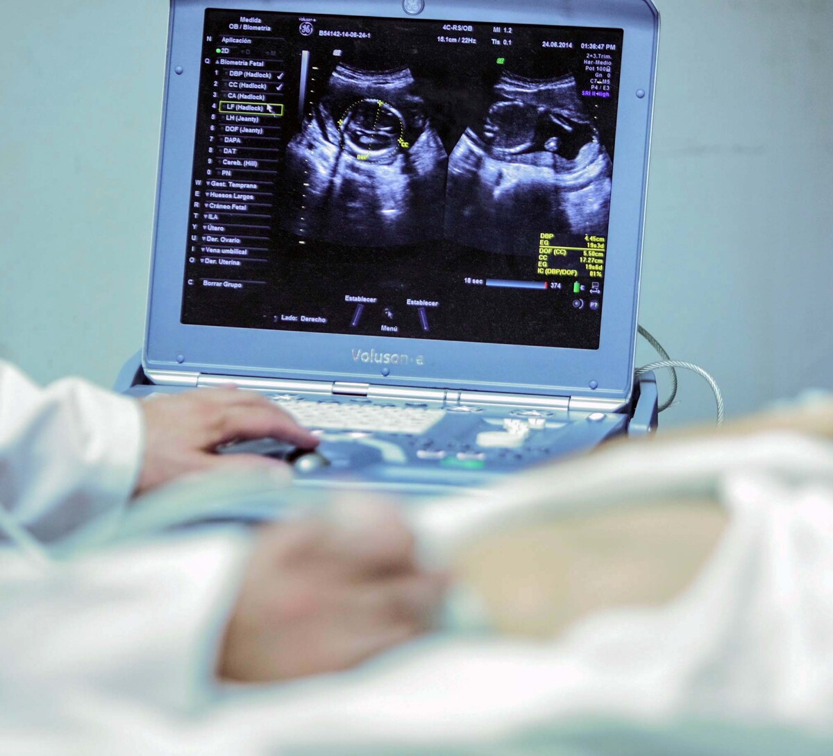 Los embarazos adolescentes se han convetido en un problema de salud púiblica en varios estados | Especial