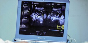 Embarazos en niñas se gestan como el nuevo reto para la salud pública