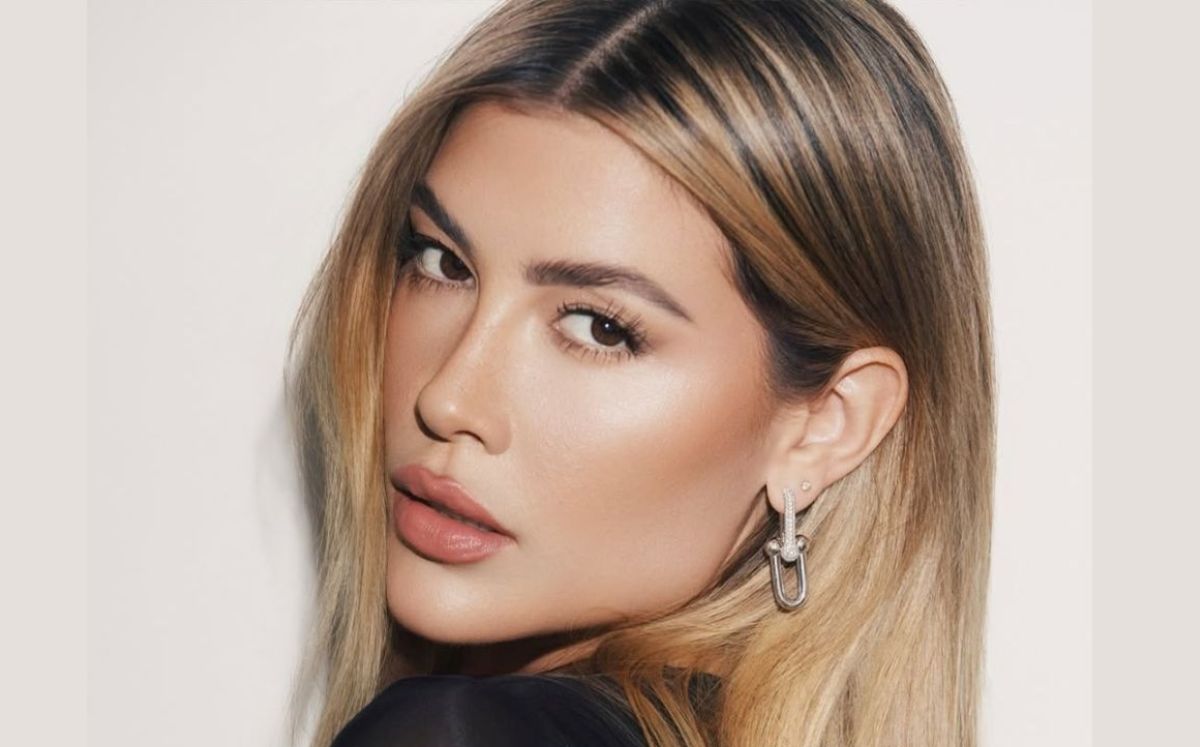 Michelle Salas reaparece en muletas tras lesión y actualiza su estado de salud: "Es duro para mí"