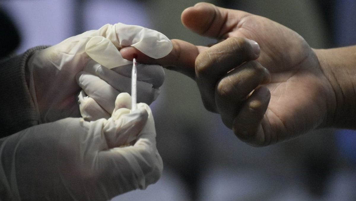 Cada 18 horas diagnostican a una persona con VIH en Puebla | Especial