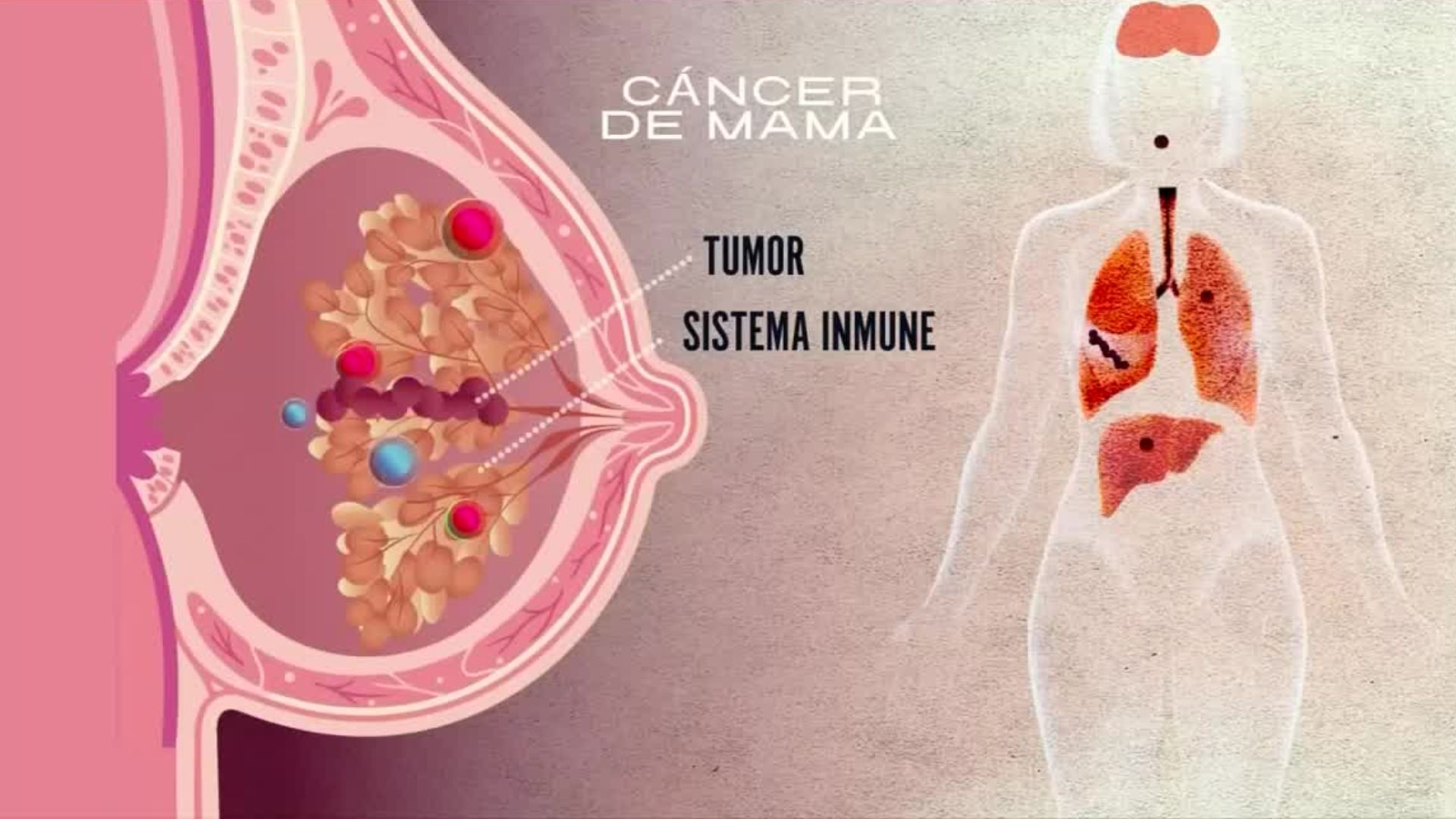 Investigadoras de la UNAM desarrollan una molécula para ataca el cáncer de mama
