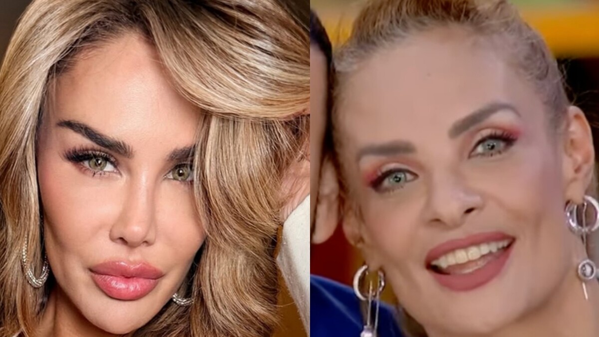 Puedes cambiar el color de tus ojos con una cirugía | Especial