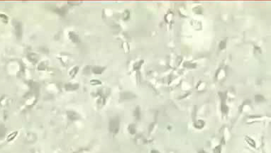 IA logra asistir en embarazo al detectar espermatozoides viables sin necesidad de cirugía