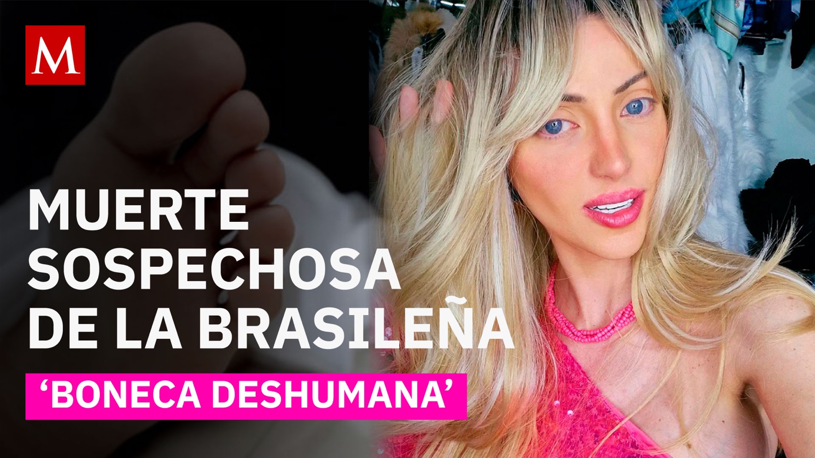 Brasil en shock: ¿Qué le ocurrió a la influencer Bárbara Jankavski conocida como ‘Barbie humana’?