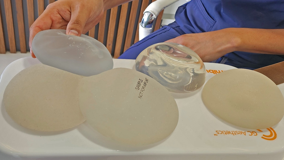 Puebla | Estiramiento facial, una alternativa para mejorar la belleza | Elvia García