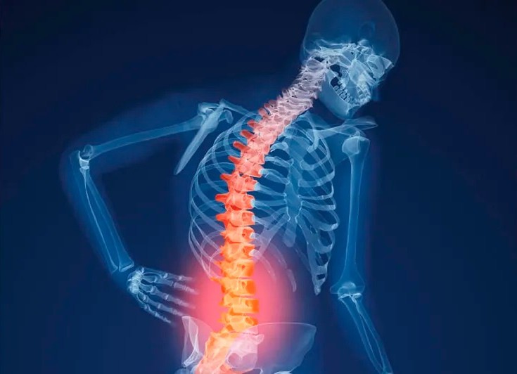 UAdeC ofrece densitometrías óseas gratuitas en Torreón. (Especial)