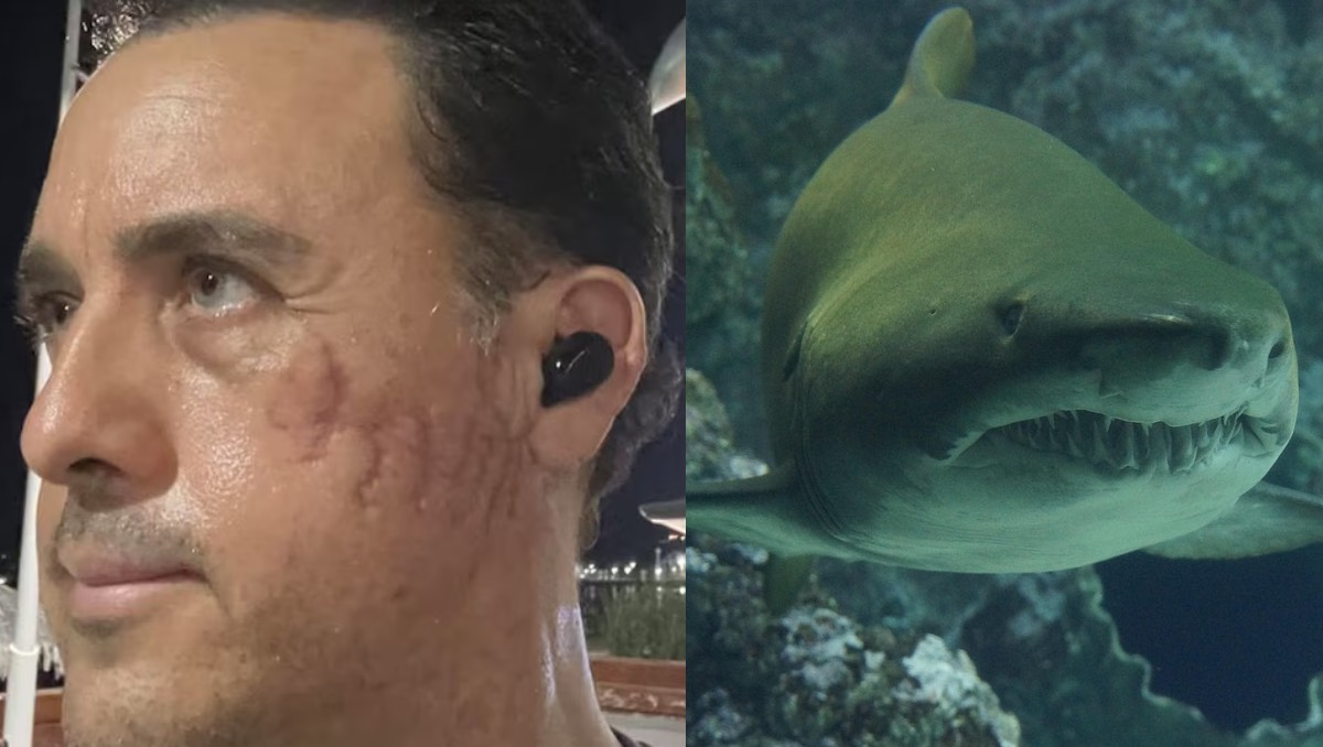 Biólogo sobrevive al ataque de un tiburón. | ESPECIAL