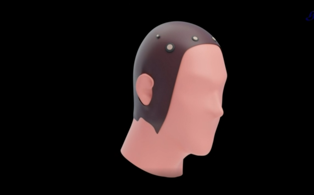 Estudios revelan que las personas optimistas comparten patrones neuronales similares