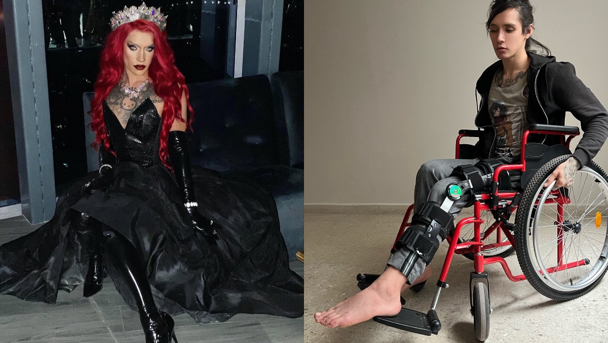 Impactante relato: Drag Queen sufre accidente en Uber Moto y lo comparte | Foto: ESPECIAL