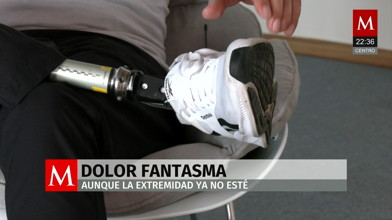 Los padecimientos tras una amputación, 'El dolor fantasma'
