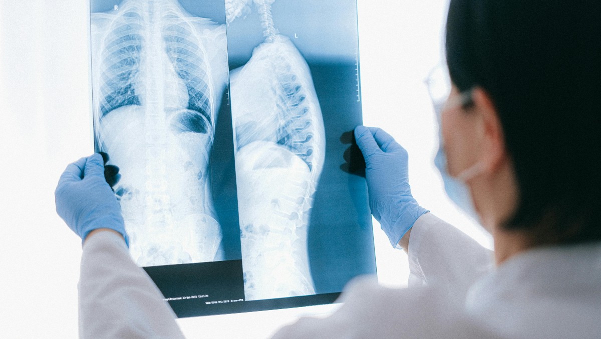 Radriografía | Pexles