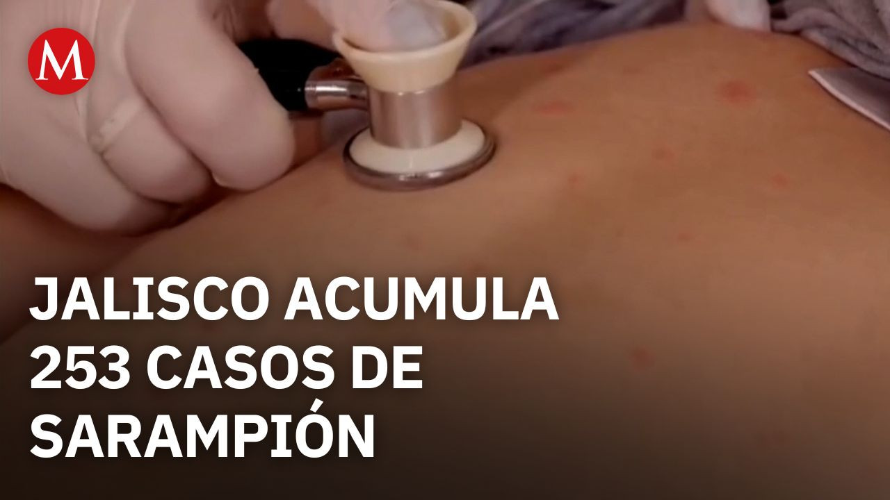 Jalisco suma 253 casos de sarampión y habilita macromódulos de vacunación