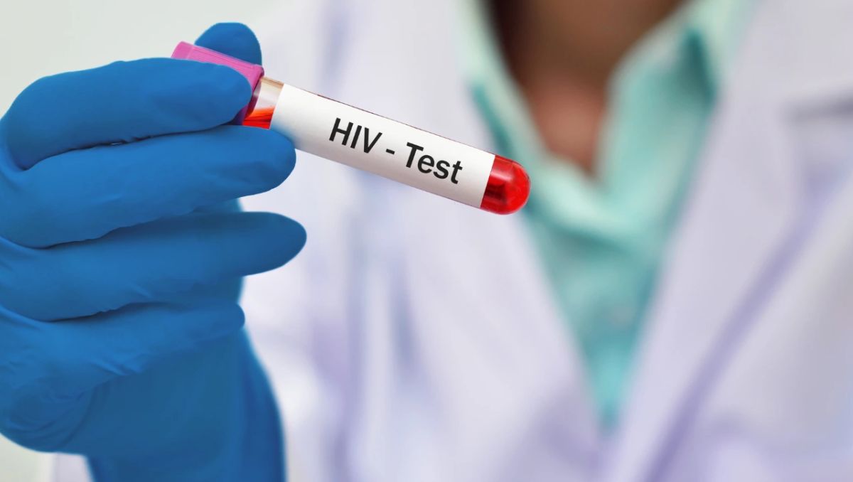 A nivel nacional hubo 8 mil 227 casos de infección por VIH en el estadío clínico 1 | Especial