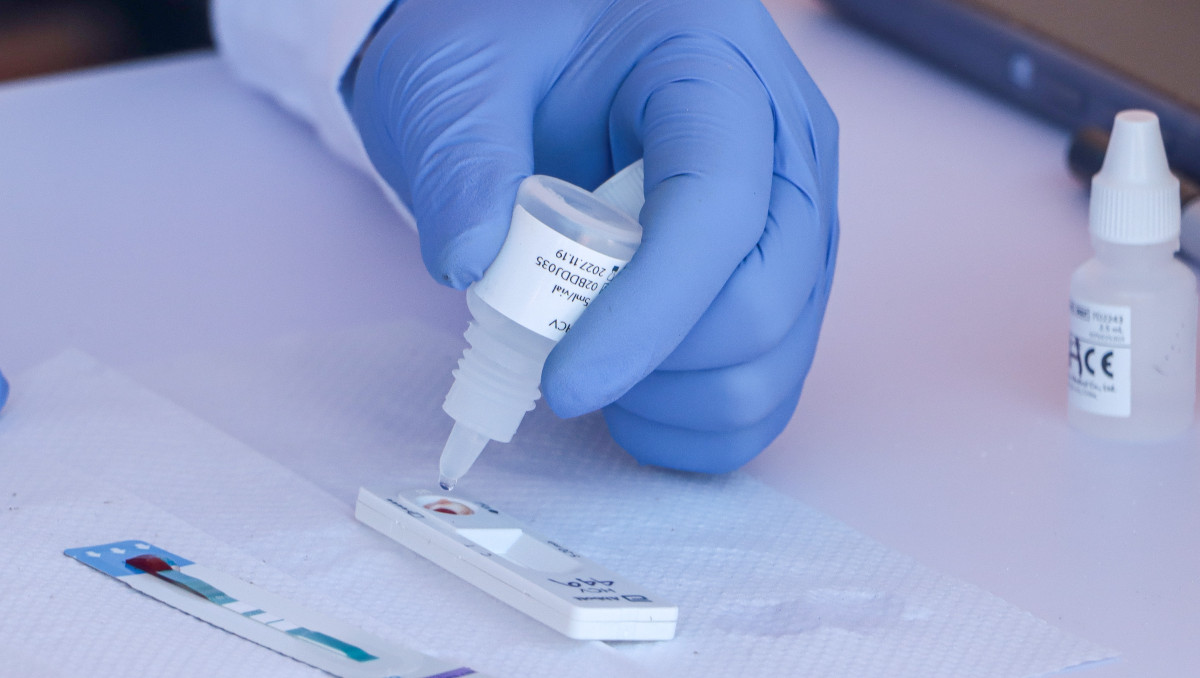 Durante 2025 cada 30 horas un poblano ha muerto por VIH/SIDA | Agencia Es Imagen