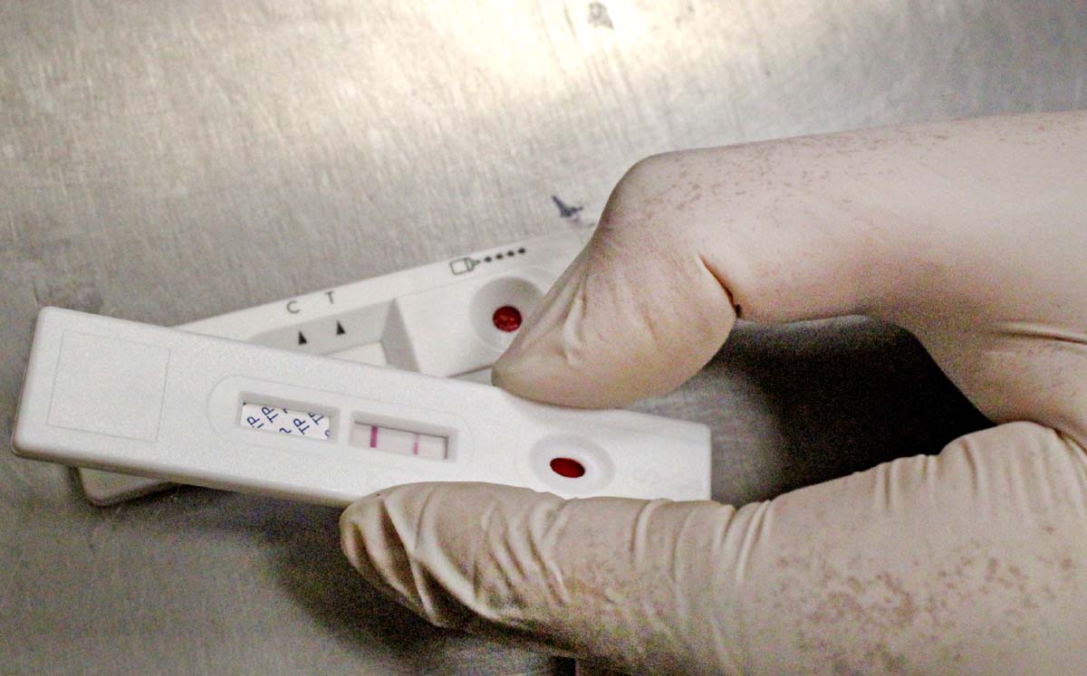 Pruebas de VIH-SIDA. l Foto: Roberto Amaya