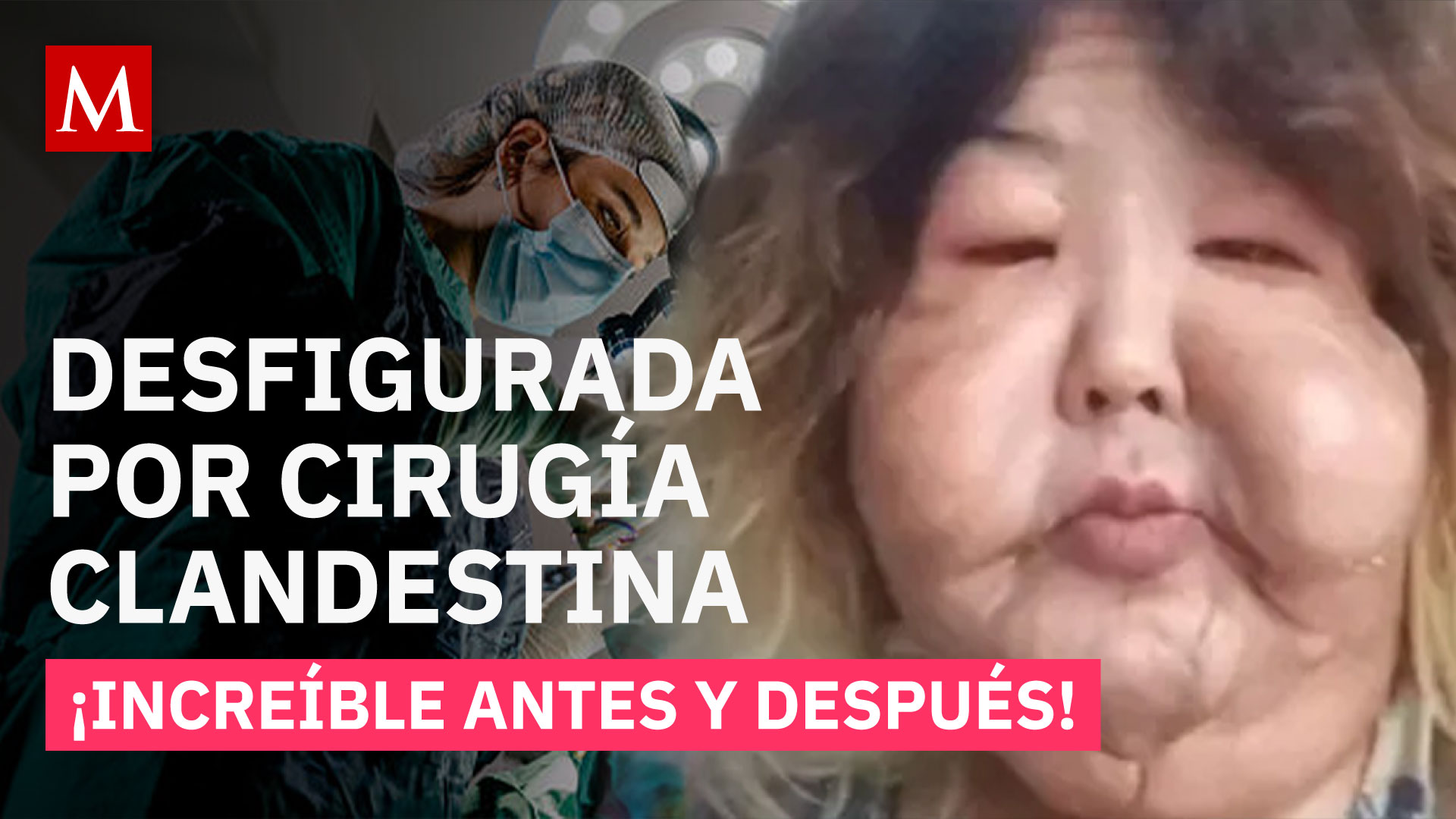 Influencer inicia reconstrucción facial tras cirugía clandestina que la desfiguró