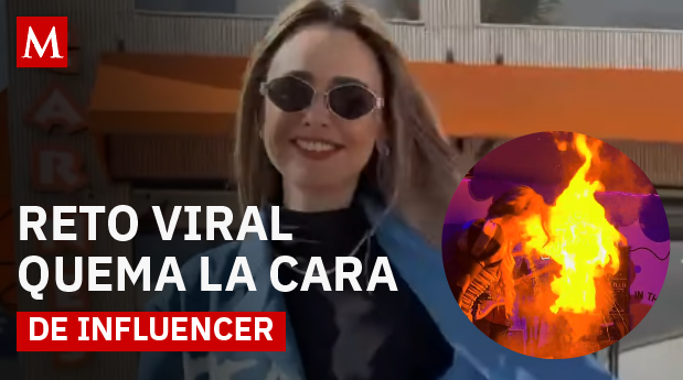 Reto viral deja a influencer con quemaduras de primer y segundo grado en el rostro