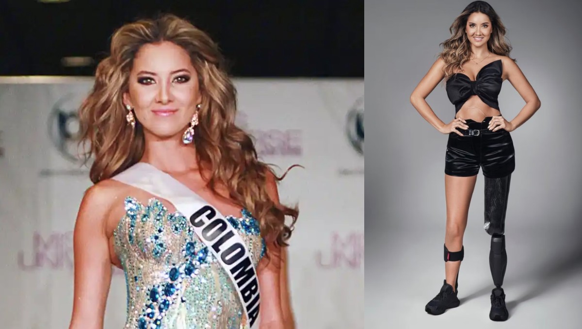 Daniela Álvarez publica fuertes imágenes de su amputación. | ESPECIAL