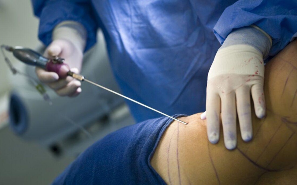 Cirugía plástica. | Especial