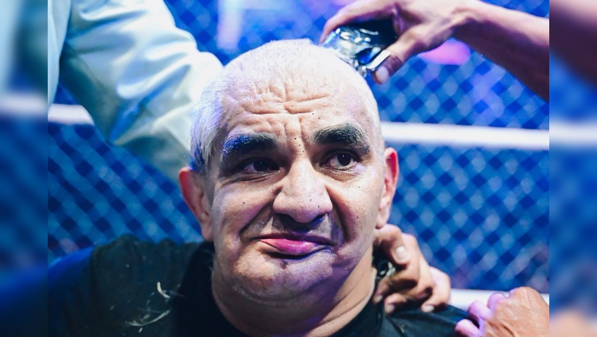 Shocker causa preocupación por su estado de salud luego de perder la cabellera en pelea