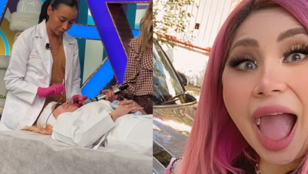 Bebeshita se somete a rejuvenecimiento facial. | FOTO. Programa Hoy y Bebeshita