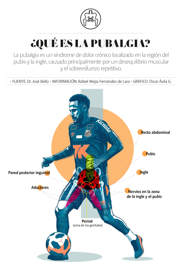 Pubalgia