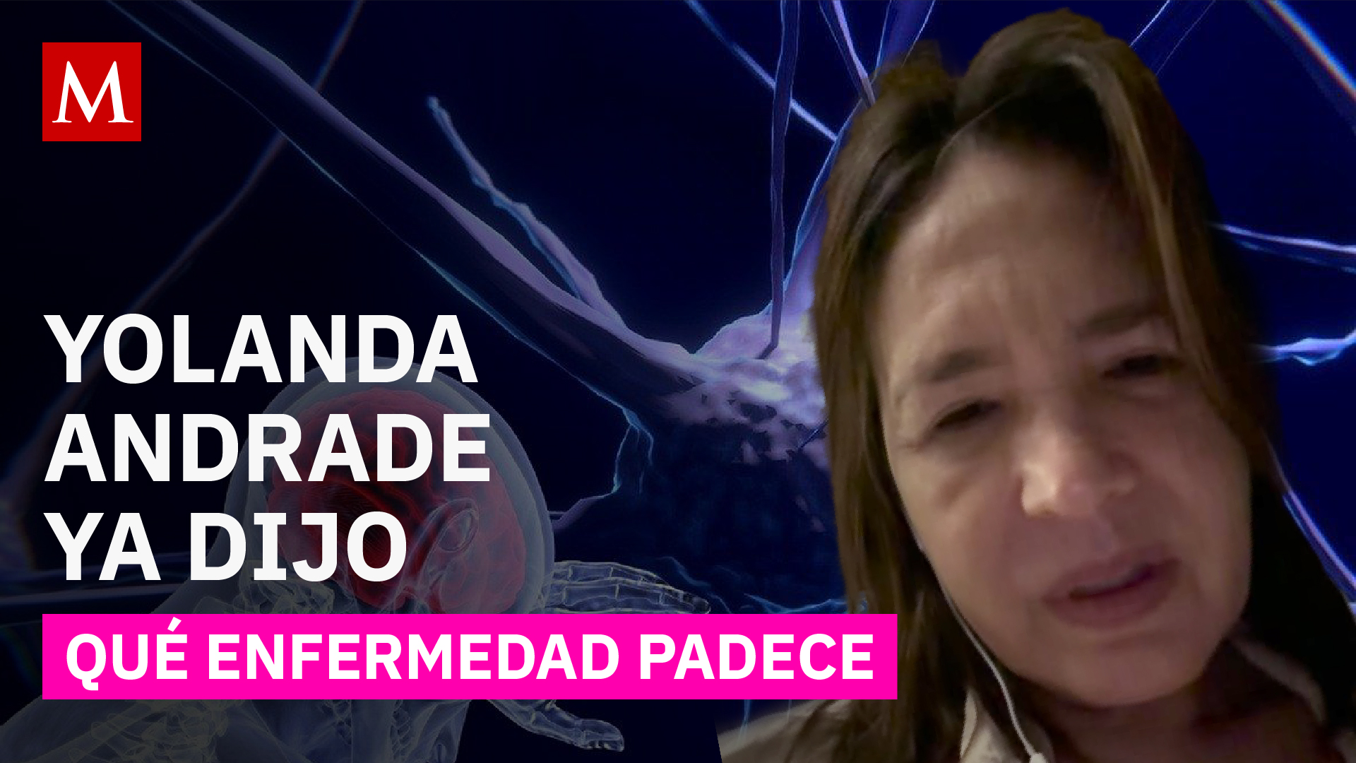Yolanda Andrade revela su lucha contra enfermedad degenerativa