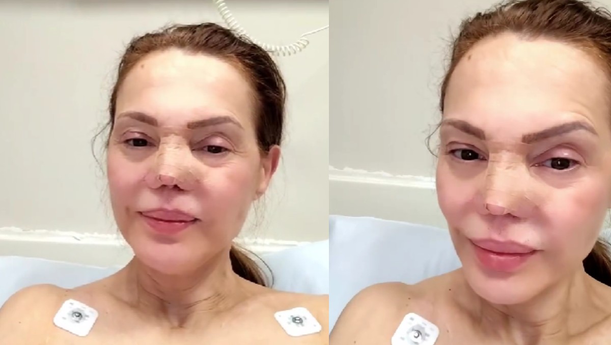 Carmen Campuzano impacta con nueva imagen tras someterse a cirugía de nariz: "Fue algo delicado" | VIDEO